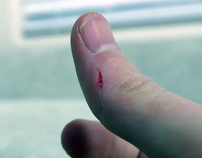 SQair injury due to the weight of the top of the purifier